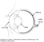 cataracts